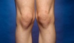 body parts-knee